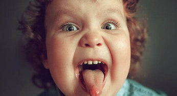 Lip and Tongue Ties