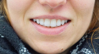 The Anatomy of Human Teeth