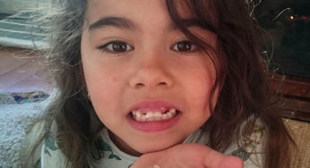 What’s Your Plan for the First Loose Tooth?