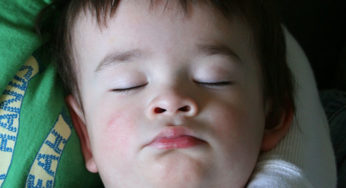 Snoring, Sleep Apnea, and Teeth