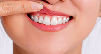 How Can I Defend Against Gum Recession?